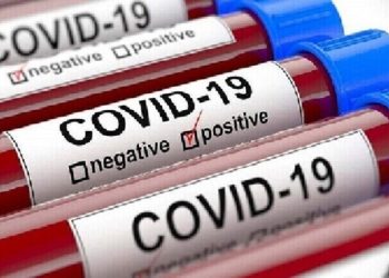 مجلس الشيوخ الأمريكي في تقرير أولي : جائحة كوفيد-19 نشأت من “حادث” في المختبر!